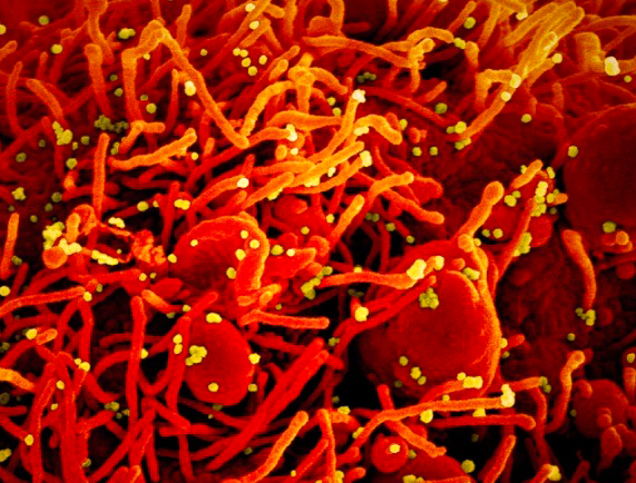 Yellow coronavirus on red cell
